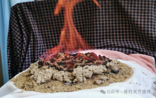 夏至已至，借“阳”发力！三伏灸开启冬病夏治黄金期