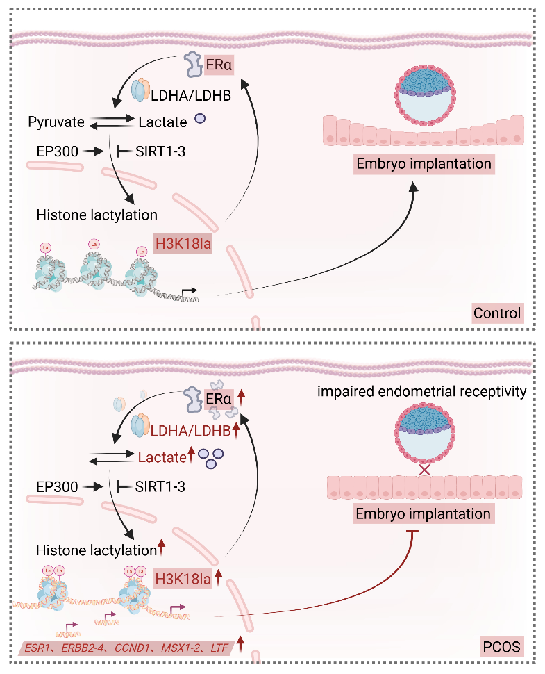 PCOS患者子宫内膜容受性建立期间H3K18la功能受损的示意图